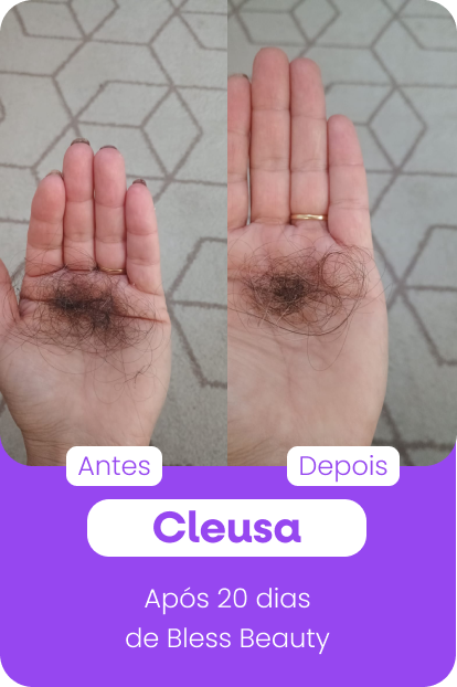 cleusa